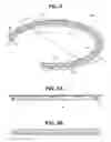 Fig. 09 - Craniotomy closures and plugs