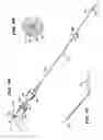 Fig. 05 - METHODS FOR PLACING MATERIALS INTO BONE