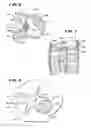 Fig. 07 - METHODS FOR PLACING MATERIALS INTO BONE