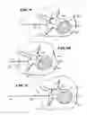 Fig. 08 - METHODS FOR PLACING MATERIALS INTO BONE