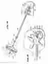 Fig. 12 - METHODS FOR PLACING MATERIALS INTO BONE