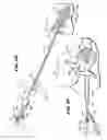 Fig. 13 - METHODS FOR PLACING MATERIALS INTO BONE