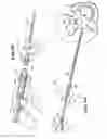 Fig. 15 - METHODS FOR PLACING MATERIALS INTO BONE