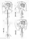 Fig. 17 - METHODS FOR PLACING MATERIALS INTO BONE