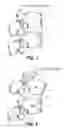 Fig. 02 - Dynamic fixation device and method of use
