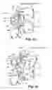 Fig. 06 - Dynamic fixation device and method of use