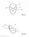 Fig. 02 - Anti-transpiration insert