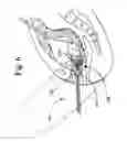 Fig. 07 - Vaginal delineating device