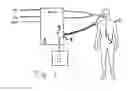 Fig. 02 - Control unit and display unit for an EMG controlled ventilator