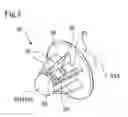 Fig. 05 - Body cavity cleaning agent