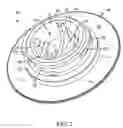 Fig. 03 - Apertured flow control element and housing structure therefor