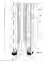 Fig. 06 - Apparatus and method for downhole steam generation and enhanced oil recovery