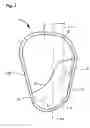 Fig. 04 - Side airbag and side airbag device