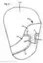 Fig. 07 - Side airbag and side airbag device