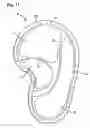 Fig. 12 - Side airbag and side airbag device