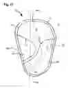 Fig. 13 - Side airbag and side airbag device
