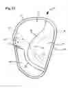 Fig. 14 - Side airbag and side airbag device