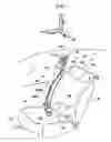 Fig. 02 - Shoulder anchor device