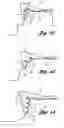 Fig. 05 - Vehicle seat assembly having layered seating system