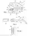 Fig. 02 - Portable light apparatus and method of attachment