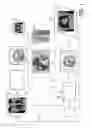Fig. 02 - Adjusting acquisition protocols for dynamic medical imaging using dynamic models