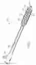 Fig. 02 - Medical Devices With Nanotextured Titanium Coating