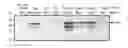 Fig. 01 - Unmarked recombinant intracellular pathogen immunogenic compositions expressing high levels of recombinant proteins