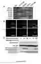 Fig. 04 - Induction of human embryonic stem cell derived cardiac pacemaker or chamber-type cardiomyocytes by manipulation of neuregulin signaling