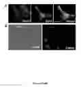 Fig. 07 - Induction of human embryonic stem cell derived cardiac pacemaker or chamber-type cardiomyocytes by manipulation of neuregulin signaling