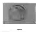 Fig. 02 - METHOD FOR EFFICIENT TRANSFER OF HUMAN BLASTOCYST-DERIVED STEM CELLS (hBS CELLS) FROM A FEEDER-SUPPORTED TO A FEEDER-FREE CULTURE SYSTEM
