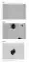 Fig. 02 - METHOD FOR PRODUCTION OF HEPATIC-LOBULE-LIKE CELL CLUSTER FROM ADIPOSE-TISSUE-DERIVED CELL