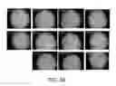 Fig. 68 - HEPATOCYTE GROWTH FACTOR RECEPTOR SPLICE VARIANTS AND METHODS OF USING SAME