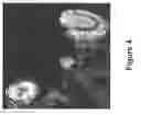 Fig. 06 - Chimeric DRG11-responsive (DRAGON) polypetides
