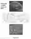 Fig. 08 - Chimeric DRG11-responsive (DRAGON) polypetides