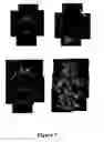 Fig. 09 - Chimeric DRG11-responsive (DRAGON) polypetides