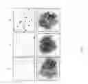 Fig. 07 - Cell lines, compositions comprising them for the treatment of melanomas, procedures to prepare the compositions, and treatment methods