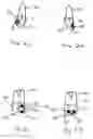 Fig. 03 - APPARATUS AND METHODS FOR CORRECTION OF ORTHODONTIC MALOCCLUSIONS