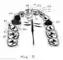 Fig. 04 - APPARATUS AND METHODS FOR CORRECTION OF ORTHODONTIC MALOCCLUSIONS