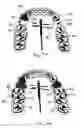 Fig. 05 - APPARATUS AND METHODS FOR CORRECTION OF ORTHODONTIC MALOCCLUSIONS