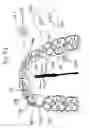 Fig. 07 - APPARATUS AND METHODS FOR CORRECTION OF ORTHODONTIC MALOCCLUSIONS