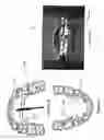 Fig. 08 - APPARATUS AND METHODS FOR CORRECTION OF ORTHODONTIC MALOCCLUSIONS