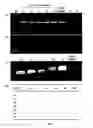Fig. 02 - DIFFERENTIAL AMPLIFICATION OF MUTANT NUCLEIC ACIDS BY PCR IN A MIXTURE OF NUCLEIC ACIDS