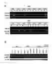 Fig. 02 - SCREENING AND THERAPEUTIC METHOD FOR NSCLC TARGETING THE CDCA8-AURKB COMPLEX