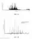 Fig. 02 - Glycoprotein Profiling of Bladder Cancer