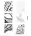 Fig. 07 - Reagents And Methods For Cancer Prognosis And Pathological Staging