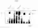 Fig. 02 - Method of diagnosing an RTK-hyperfunction induced disorder