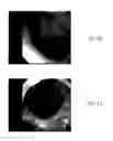 Fig. 03 - Methods for treatment for ulcerative colitis in mammals