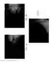 Fig. 04 - Methods for treatment for ulcerative colitis in mammals