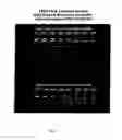 Fig. 02 - Devices, systems and methods for improving memory and/or cognitive function through brain delivery of siRNA
