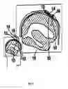 Fig. 07 - Devices, systems and methods for improving memory and/or cognitive function through brain delivery of siRNA